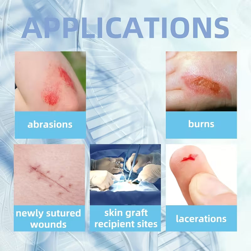 4"x4" Xeroform Petrolatum Gauze Dressing, 25 Individual Packs, Non-Adherent Wound