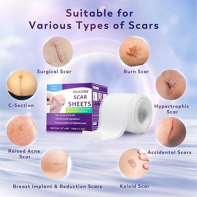Silicone Scar Sheets, Silicone Scar Tape(1.6"x 60" Roll-1.5M), for Surgical Scars, Burn, C-Section, Keloid Scars, Acne